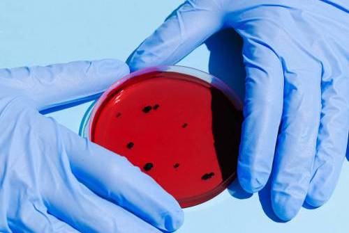 analisis sangre palma